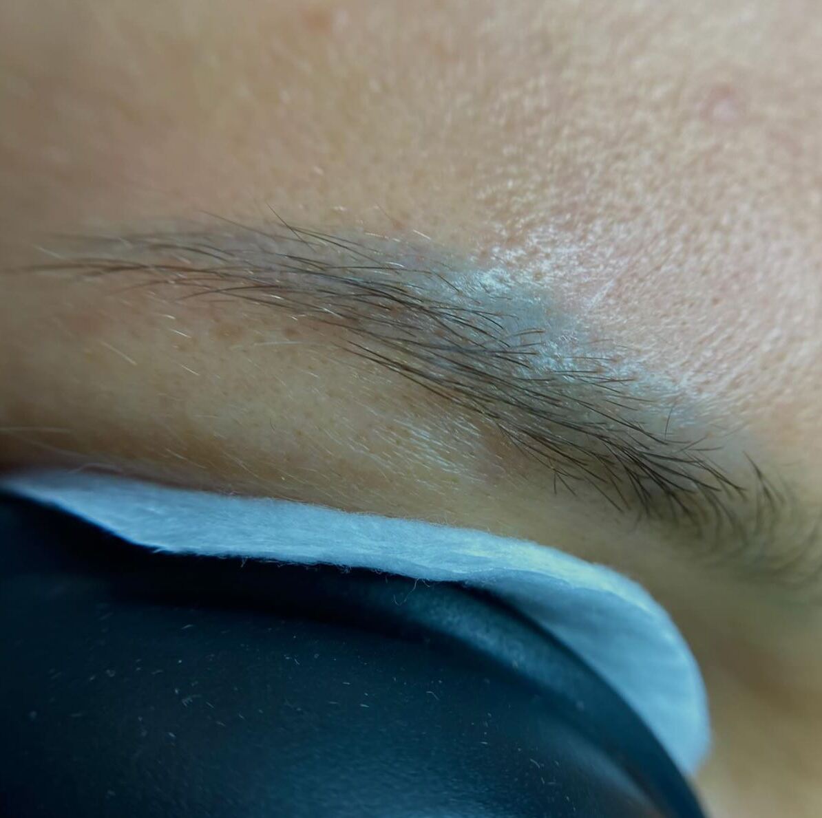 Health and Safety  Laser Therapy