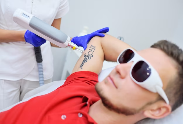 Unlocking Skin Transformation: Laser Tattoo Removal in Australia – A Life-Changing Experience!
