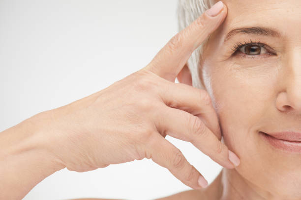 best way to get rid of crows feet
